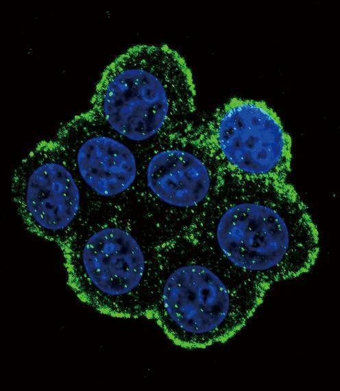 Anti-BMPR1A (N-term K36) Antibody