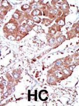 Anti-BMPR1A (Center C180) Antibody