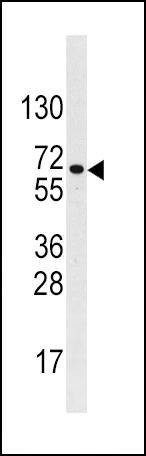 Anti-BMPR1A (N-term) Antibody