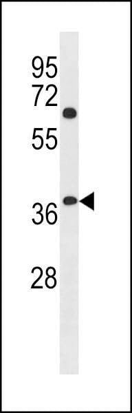 Anti-NHLRC3 (C-term) Antibody