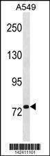Anti-RRM1 (N-term) Antibody