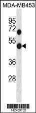 Anti-GDI1 (C-term) Antibody