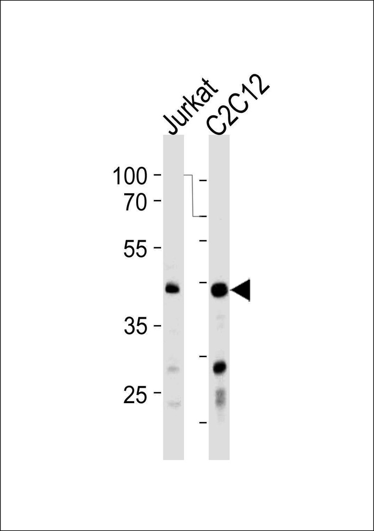 Anti-POLDIP3 (N-term) Antibody