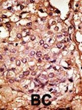 Anti-Chemokine Receptor D6 (CCBP2) (N-term) Antibody