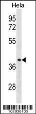 Anti-Chemokine Receptor D6 (CCBP2) (C-term) Antibody