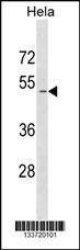 Anti-SMAD1 (N-term) Antibody