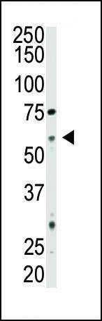 Anti-CD73 (NT5E) (C-term) Antibody