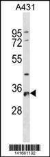 Anti-RPS6 (N-term) Antibody