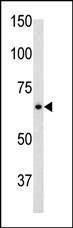 Anti-GFAP (C-term) Antibody