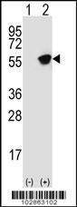 Anti-GFAP (C-term) Antibody