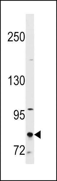 Anti-CTAGE1 (Center) Antibody