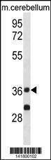 Anti-Mouse PPP2CA (Center) Antibody