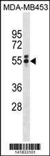 Anti-T (N-term) Antibody