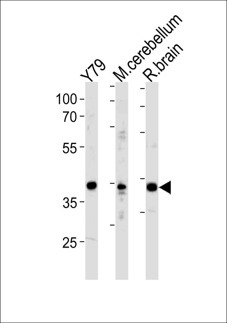 Anti-NeuroD1 (C-term) Antibody