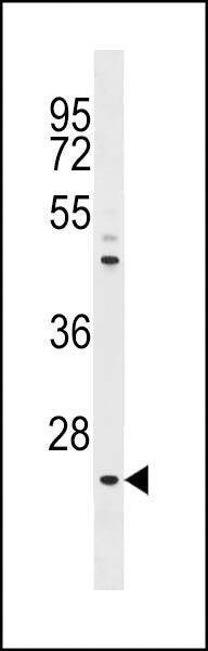Anti-Neurogenin1 (NeuroG1) (N-term) Antibody