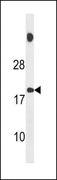 Anti-SPNXB (Center) Antibody