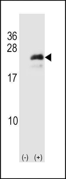 Anti-Neurogenin3 (N-term) Antibody