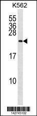 Anti-RAB27A (C-term) Antibody