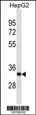 Anti-SFXN1 (C-term) Antibody
