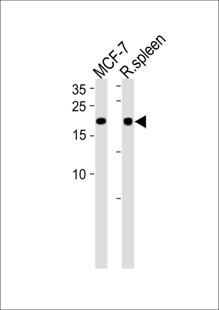 Anti-CNBP (Center) Antibody