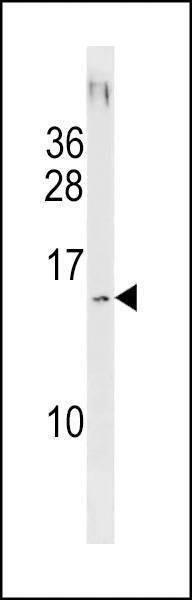 Anti-SAMD13 (C-term) Antibody