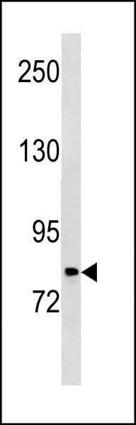 Anti-PLOD2 (C-term) Antibody