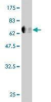 Anti-FLI1 Antibody