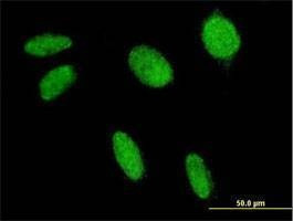 Anti-FLI1 Antibody