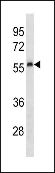 Anti-Plau (C-term) Antibody