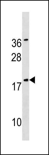 Anti-SNX12 (Center) Antibody