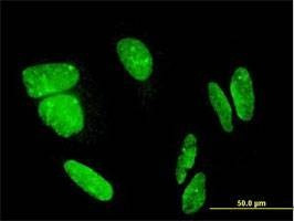 Anti-FLJ23834 Antibody