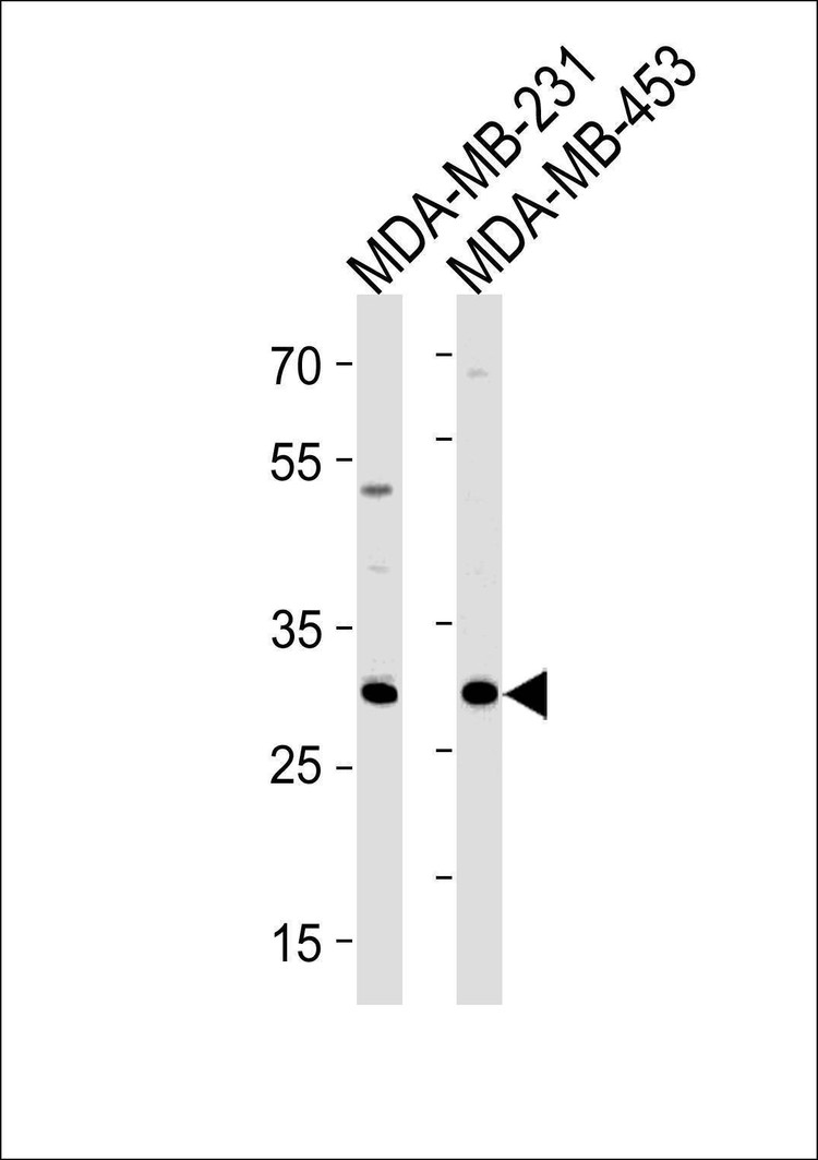 Anti-ASB11 (N-term) Antibody