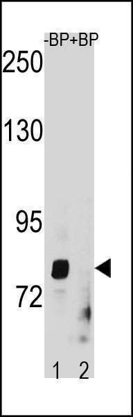 Anti-ZMAT1 (C-term) Antibody