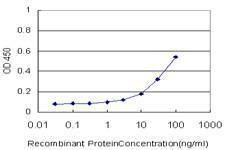 Anti-FLJ31951 Antibody