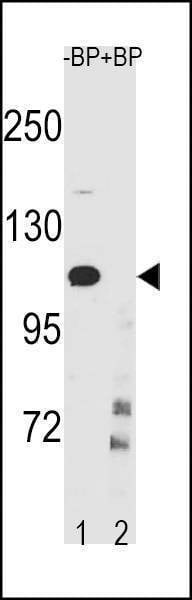 Anti-IKKB (Center Y609) Antibody