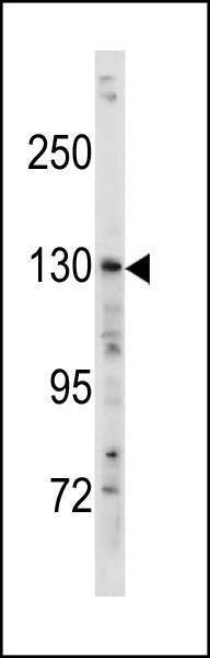 Anti-TSC1 (Center T417) Antibody