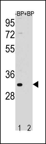 Anti-FAM26F (C-term) Antibody