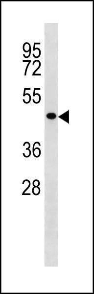 Anti-TP53 (C-term) Antibody