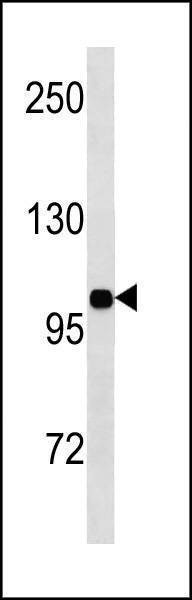 Anti-INSR (N-term) Antibody