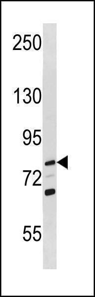 Anti-RECQL (Center) Antibody