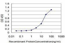 Anti-FLT4 Antibody