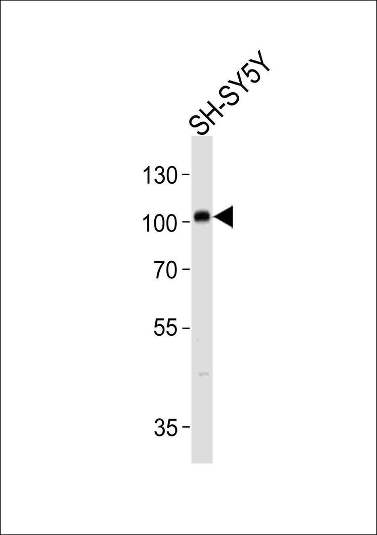 Anti-PROX1 (S197) Antibody