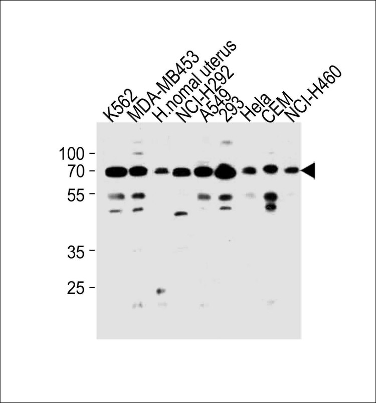 Anti-PARP3 (N-term) Antibody