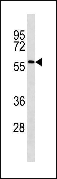 Anti-ACSF2 (C-term) Antibody