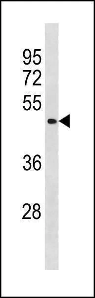 Anti-BCL6B (Center) Antibody