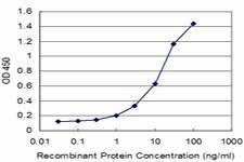 Anti-FOLR2 Antibody