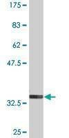 Anti-FOLR2 Antibody