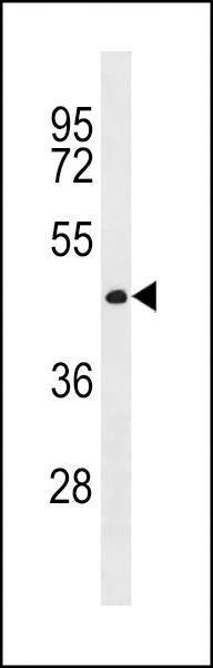 Anti-CWC27 (C-term) Antibody