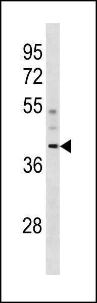 Anti-CCDC83 (N-term) Antibody