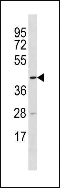 Anti-TTC5 (C-term) Antibody